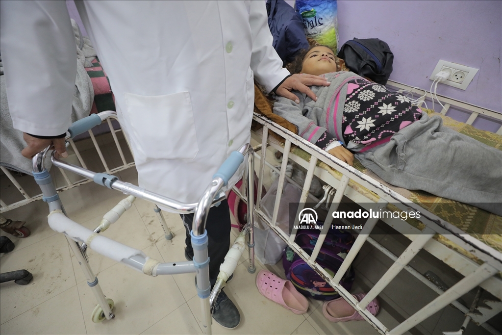 İsrail saldırısında bir bacağını kaybeden Filistinli doktor, görevine devam ediyor