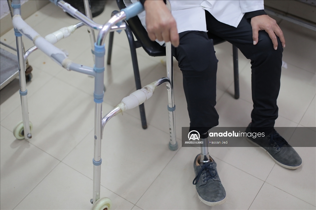 İsrail saldırısında bir bacağını kaybeden Filistinli doktor, görevine devam ediyor