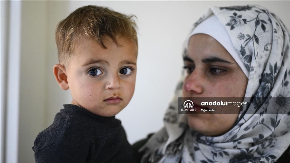 Suriye'de işitme engelli çocuklar cihazlarla ilk kez duymanın sevincini yaşadı