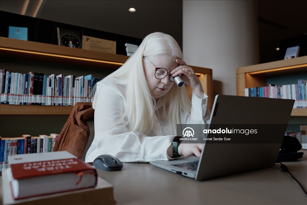 Dünya Nadir Hastalıklar Günü: "Albino olmak"