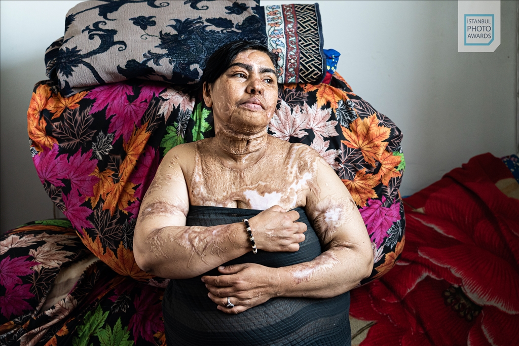 İstanbul Photo Awards'un 2025 kazananları açıklandı - Tekil Portre Üçüncülük Ödülü