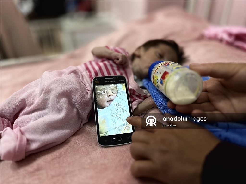 Gıda krizinin yaşandığı Gazze'de 4 aylık bebek yetersiz beslenmeyle mücadele ediyor