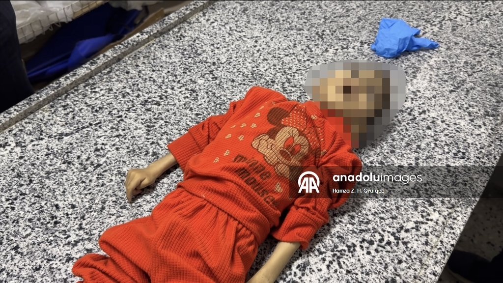 İsrail ablukası altındaki Gazze'de 4 yaşındaki Mustafa şiddetli yetersiz beslenme nedeniyle hayatını kaybetti