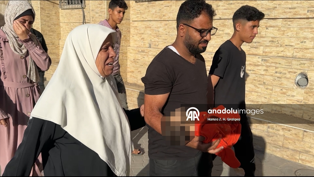 İsrail ablukası altındaki Gazze'de 4 yaşındaki Mustafa şiddetli yetersiz beslenme nedeniyle hayatını kaybetti