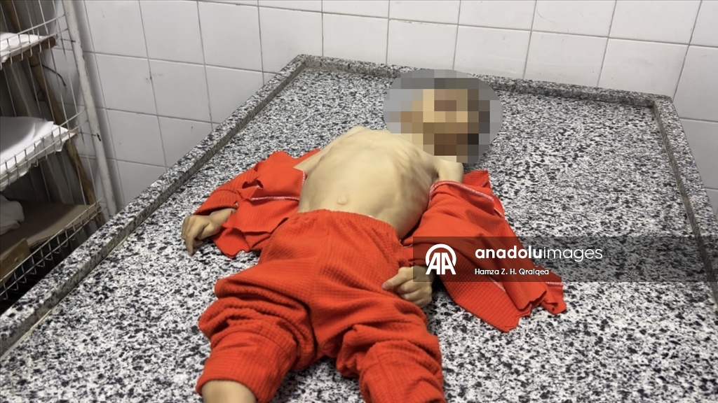 İsrail ablukası altındaki Gazze'de 4 yaşındaki Mustafa şiddetli yetersiz beslenme nedeniyle hayatını kaybetti