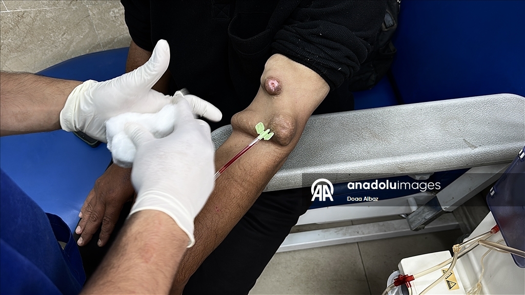 Han Yunus'taki Nasır Hastanesi, kısıtlı imkanlara rağmen diyaliz hastalarına hizmet vermeyi sürdürüyor