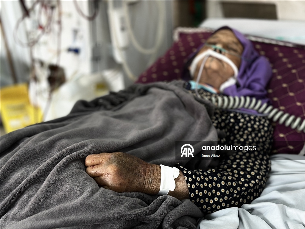 Han Yunus'taki Nasır Hastanesi, kısıtlı imkanlara rağmen diyaliz hastalarına hizmet vermeyi sürdürüyor