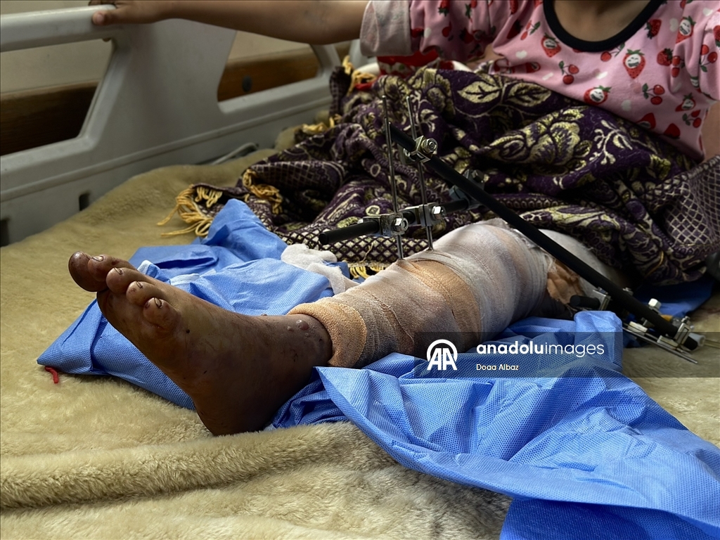 İsrail saldırısında bacaklarını kaybeden Sila ile ailesi hayatta kalma mücadelesi veriyor