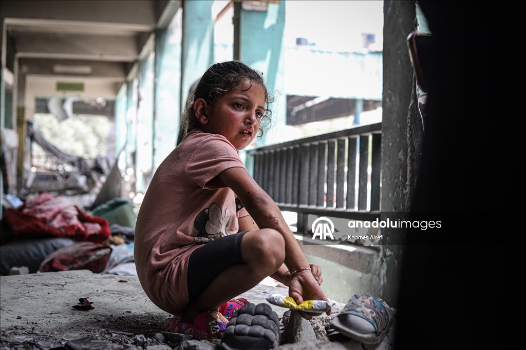 A Palestinian girl miraculously rescued from the flames
