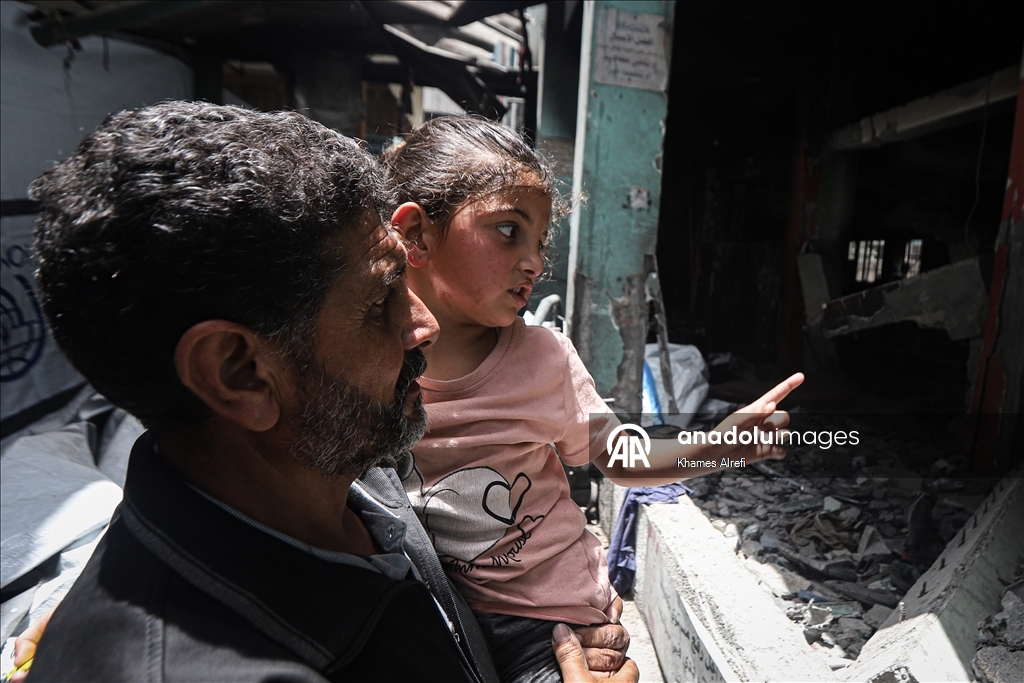A Palestinian girl miraculously rescued from the flames