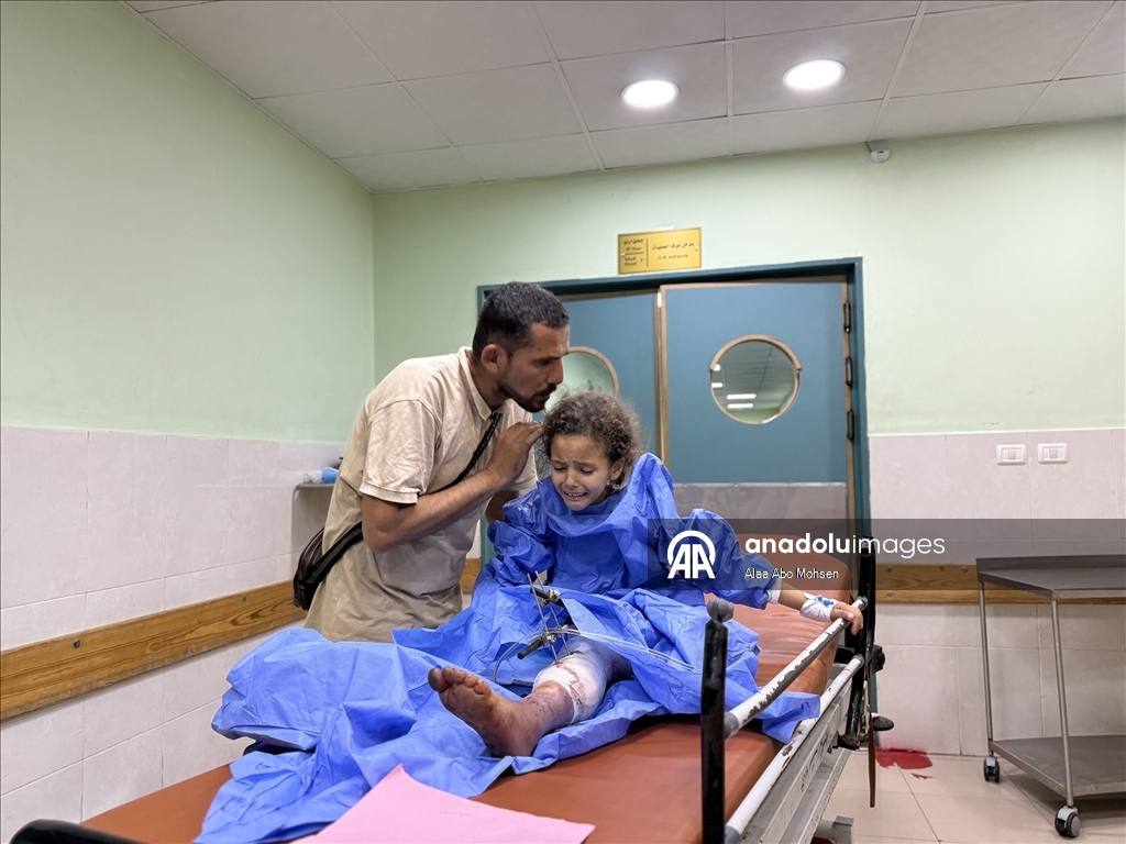 İsrail'in saldırısında bir bacağını kaybeden Filistinli çocuk Sila'nın diğer bacağı da ampute edildi