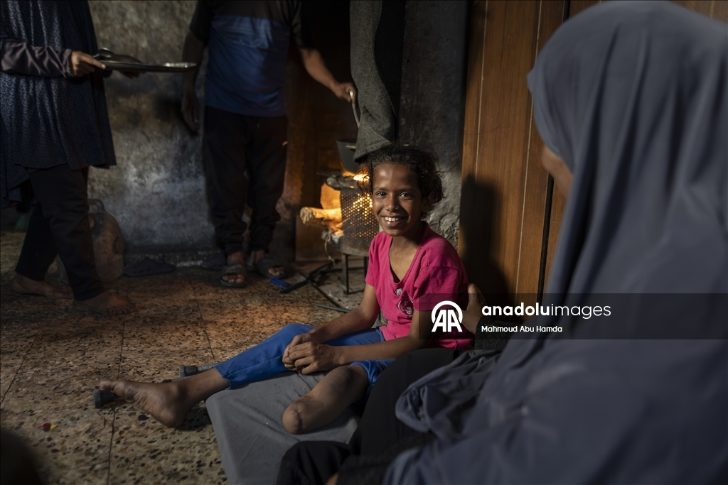 Vajza palestineze që humbi këmbën në sulmin izraelit pret të ketë një këmbë protetike