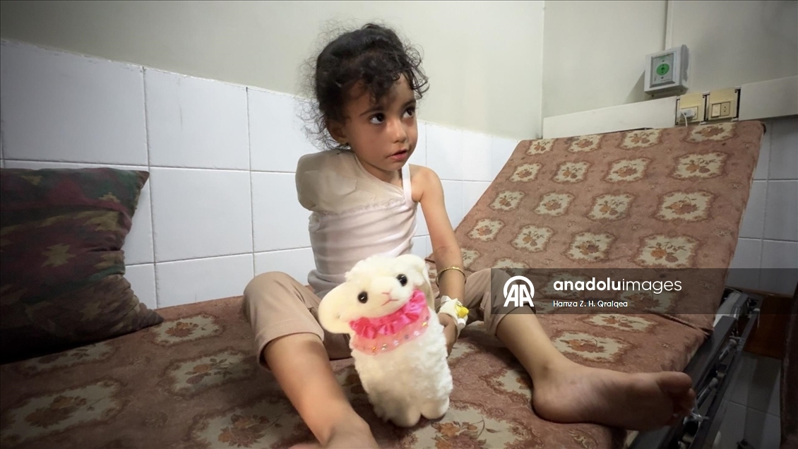 Gazze'de ailesinin umudu olan çocuk, İsrail saldırısında kolunu kaybetti