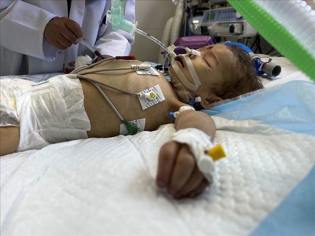 Filistinli ailenin tek çocuğu olan 2 yaşındaki Meryem'in yaşamı tehdit altında