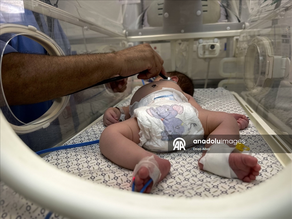 Gazze'de prematüre bebekler hayatta kalma mücadelesi veriyor