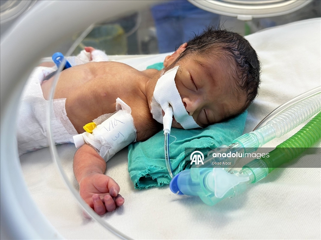 Gazze'de prematüre bebekler hayatta kalma mücadelesi veriyor