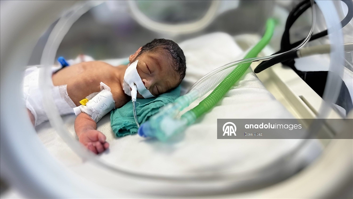 Gazze'de prematüre bebekler hayatta kalma mücadelesi veriyor