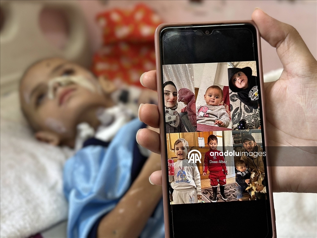 İsrail saldırısında tüm ailesini kaybeden Gazzeli çocuk, yaşam mücadelesi veriyor