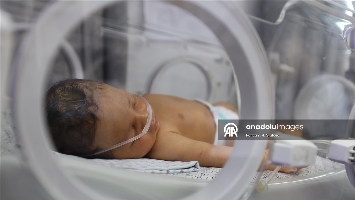 Gazze’de prematüre bebekler mama yetersizliğiyle karşı karşıya