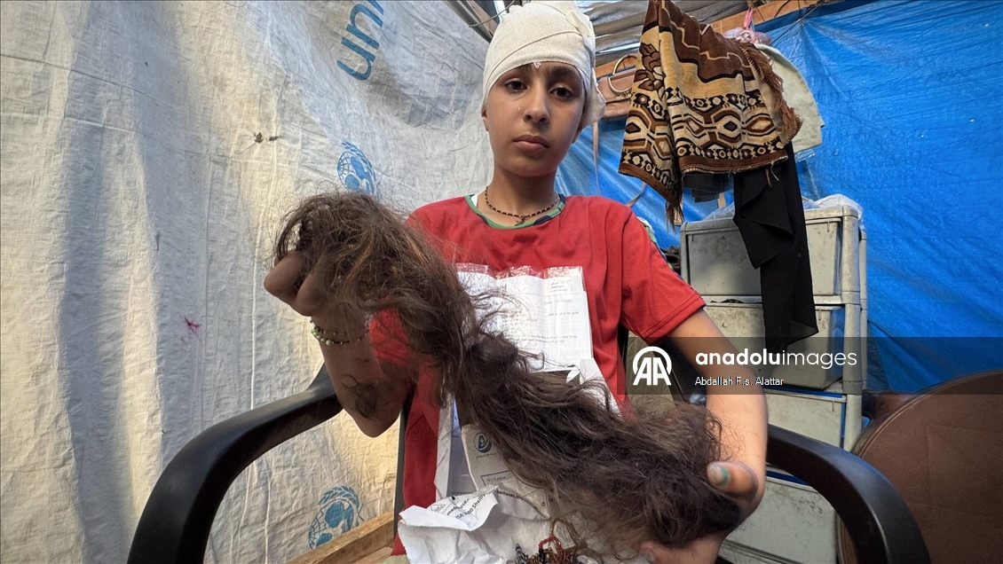 Salıncakta oynarken İsrail saldırısında başından yaralanan Gazzeli Hala, saçlarına kavuşacağı günün hayalini kuruyor