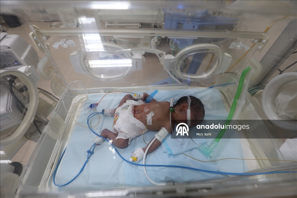 Gazze'de prematüre bebekler hayatta kalma mücadelesi veriyor