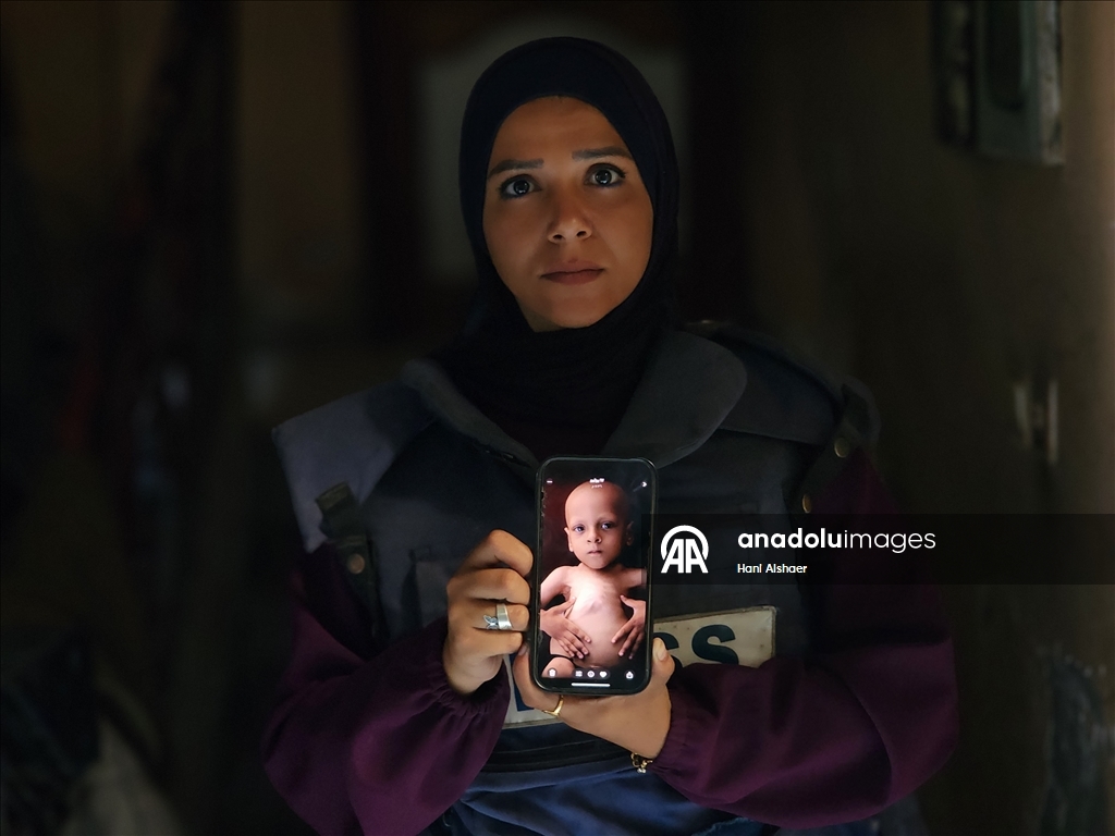 Gazze’de açlıkla mücadele eden AA serbest habercileri insani krizi aktarmayı sürdürüyor