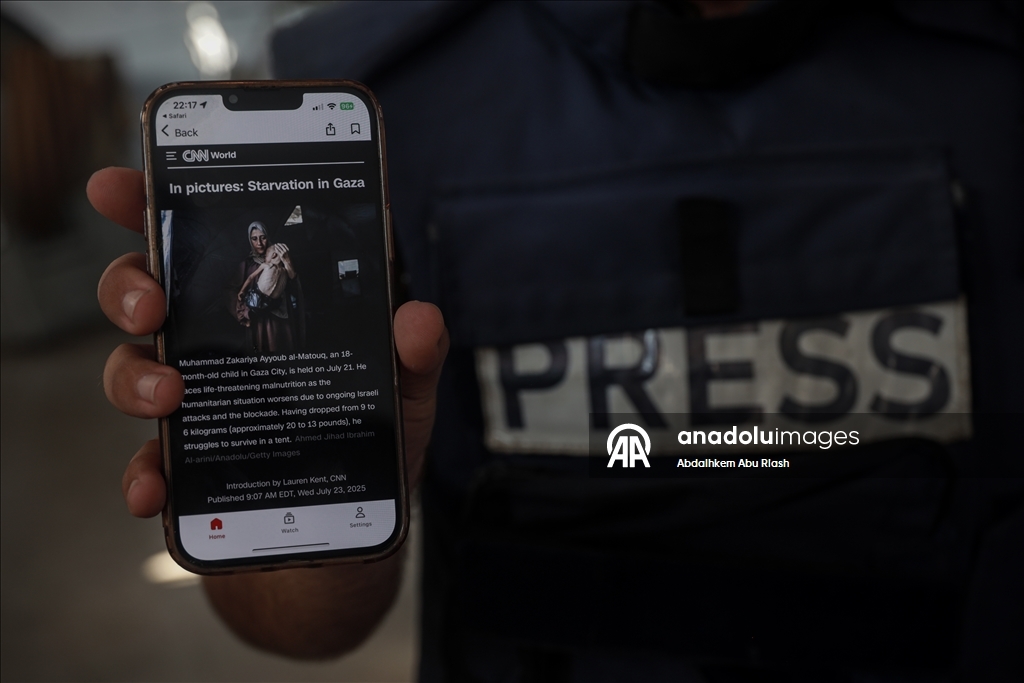 Gazze’de açlıkla mücadele eden gazeteciler, insani krizi aktarmayı sürdürüyor