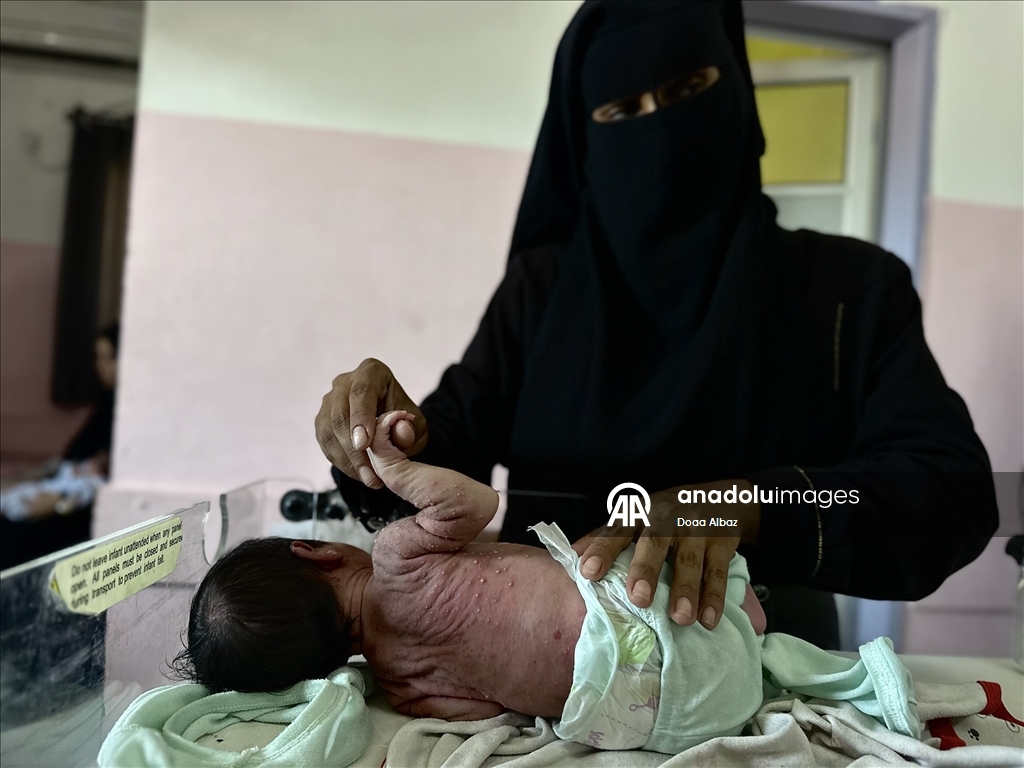 Gazze'de bebekler, mama ve ilaç eksikliğinin yanı sıra sıcak havayla da mücadele ediyor