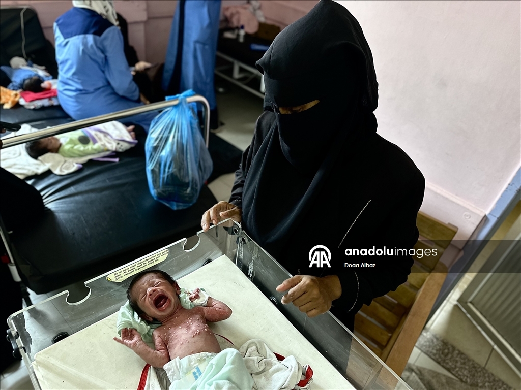 Gazze'de bebekler, mama ve ilaç eksikliğinin yanı sıra sıcak havayla da mücadele ediyor