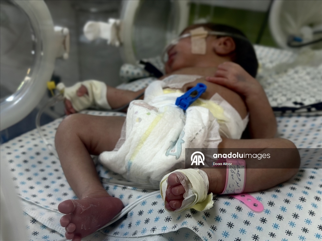 Gazze'de bebekler, mama ve ilaç eksikliğinin yanı sıra sıcak havayla da mücadele ediyor