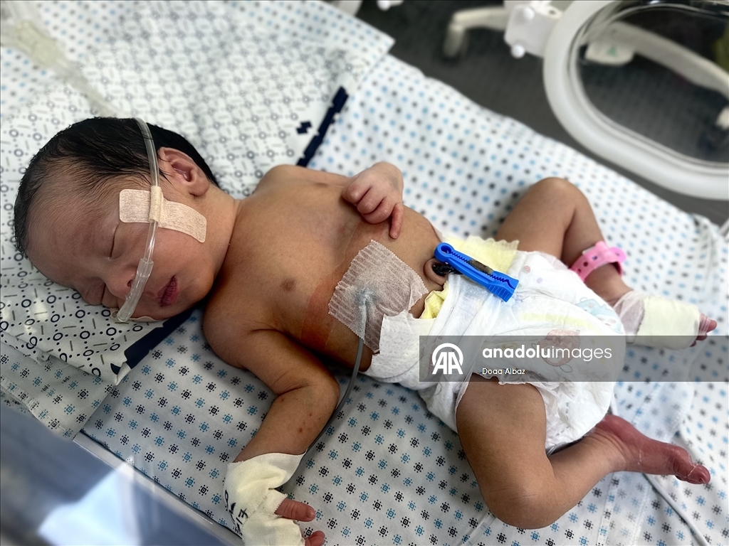 Gazze'de bebekler, mama ve ilaç eksikliğinin yanı sıra sıcak havayla da mücadele ediyor