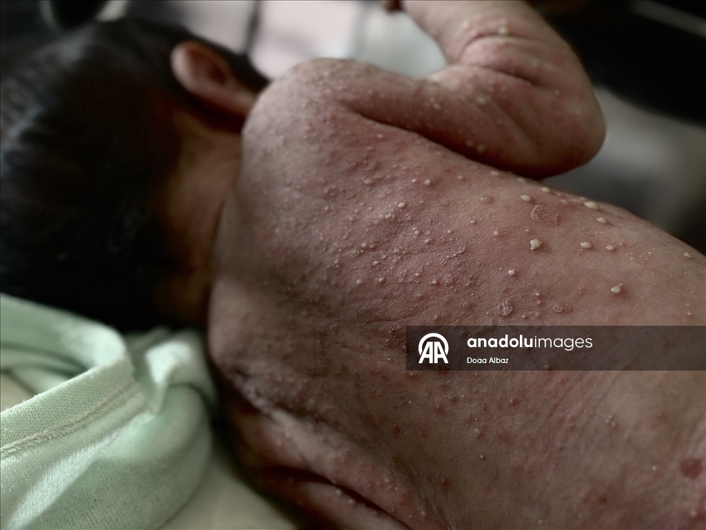 Newborns in Gaza struggle with lack of formula and medicine
