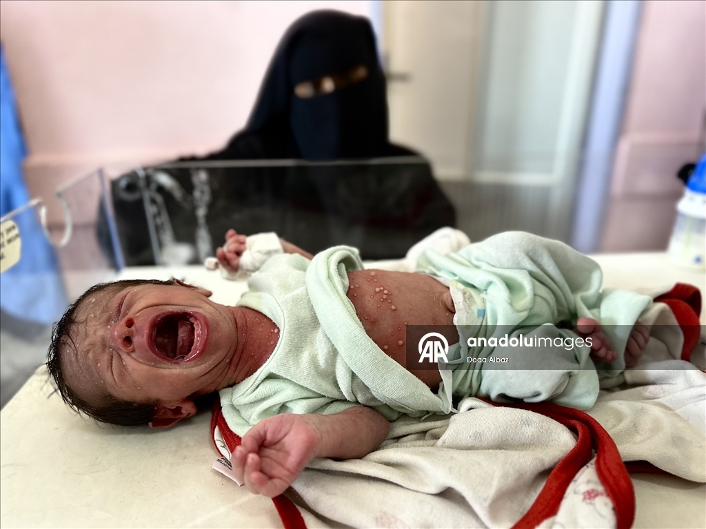 Gazze'de bebekler, mama ve ilaç eksikliğinin yanı sıra sıcak havayla da mücadele ediyor