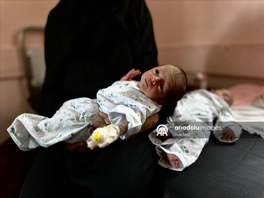 Gazze'de bebekler, mama ve ilaç eksikliğinin yanı sıra sıcak havayla da mücadele ediyor
