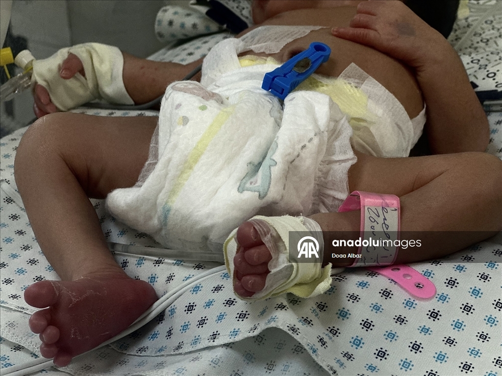 Gazze'de bebekler, mama ve ilaç eksikliğinin yanı sıra sıcak havayla da mücadele ediyor