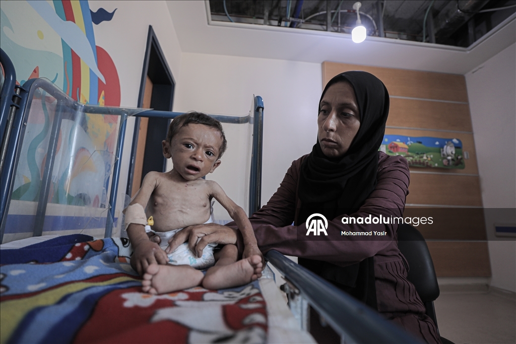 7-month-old baby’s life at risk in Gaza as Israeli blockade drives region to famine