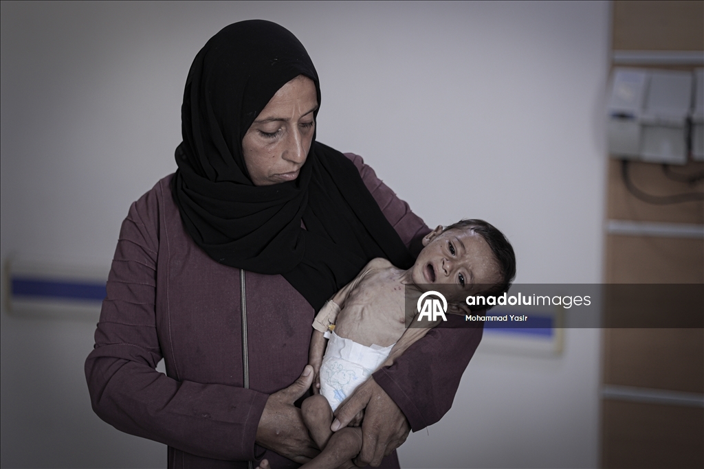 7-month-old baby’s life at risk in Gaza as Israeli blockade drives region to famine