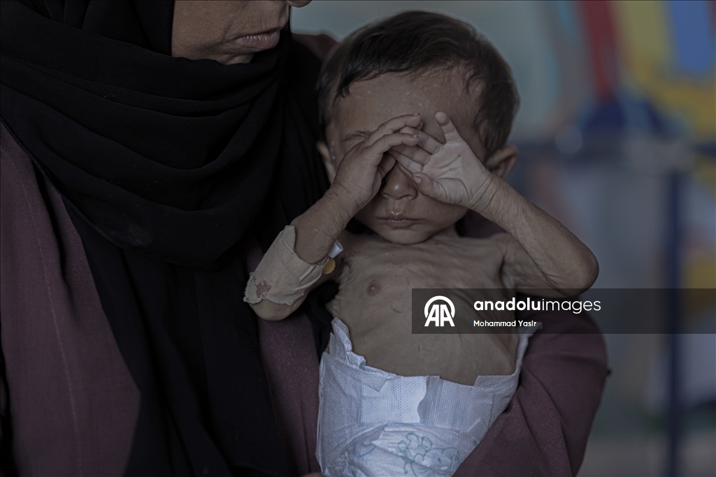 7-month-old baby’s life at risk in Gaza as Israeli blockade drives region to famine
