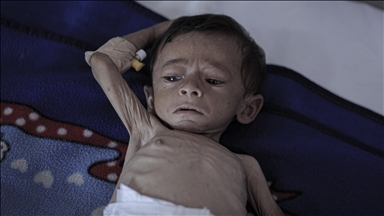 7-month-old baby’s life at risk in Gaza as Israeli blockade drives region to famine