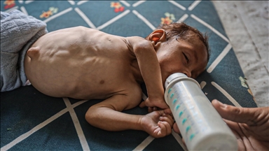 İsrail'in açlığa mahkum ettiği Gazze'de bebekler, süt yerine su ile besleniyor