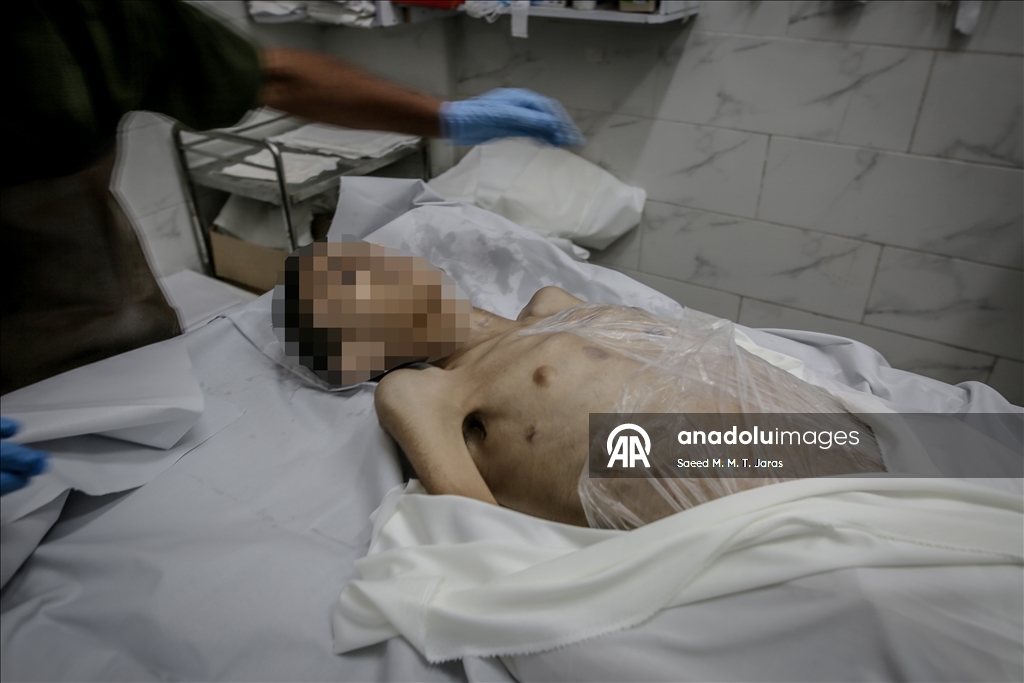 В осажденном секторе Газа от голода скончался 18-летний палестинец
