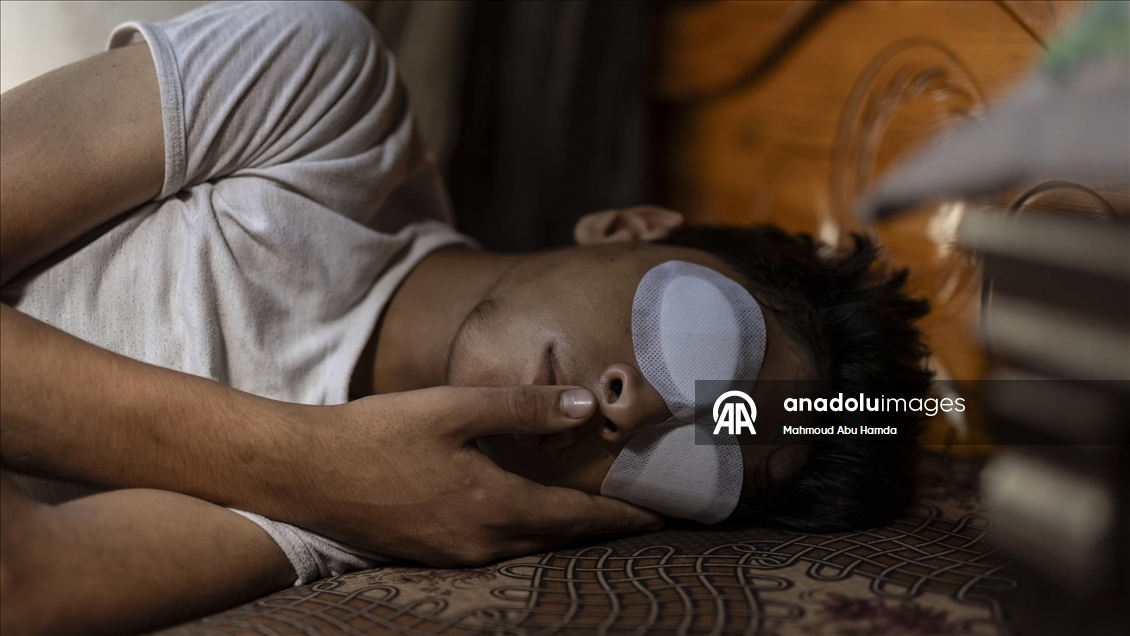 İnsani yardım kuyruğunda İsrail askerlerinin saldırısında vurulan Taha, görme yetisini kaybetti