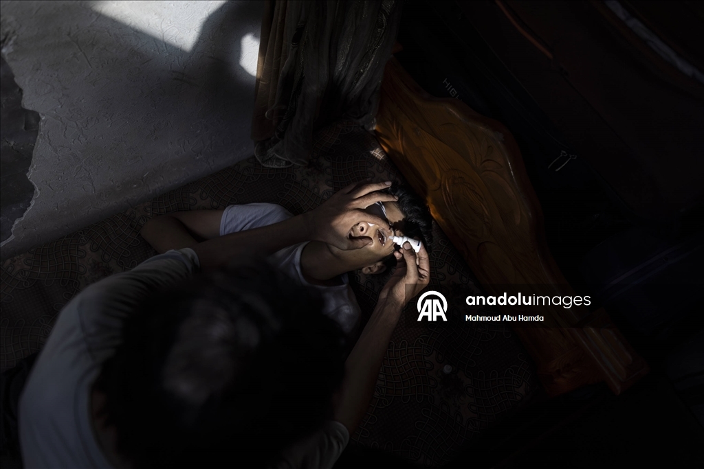 İnsani yardım kuyruğunda İsrail askerlerinin saldırısında vurulan Taha, görme yetisini kaybetti