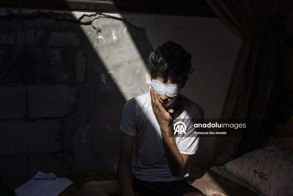 İnsani yardım kuyruğunda İsrail askerlerinin saldırısında vurulan Taha, görme yetisini kaybetti