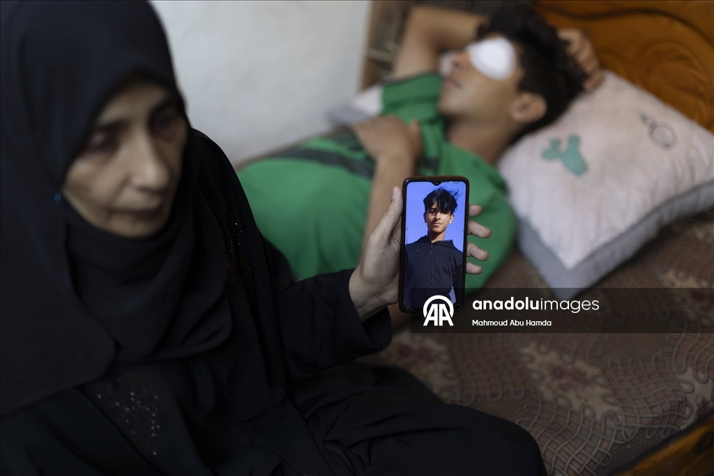 İnsani yardım kuyruğunda İsrail askerlerinin saldırısında vurulan Taha, görme yetisini kaybetti