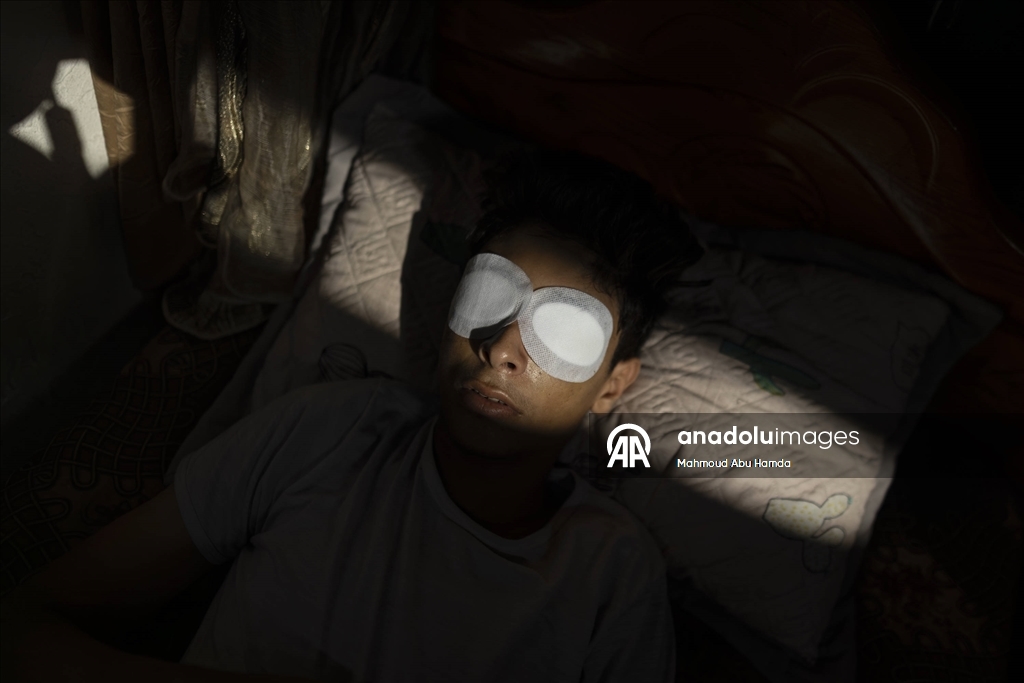 İnsani yardım kuyruğunda İsrail askerlerinin saldırısında vurulan Taha, görme yetisini kaybetti