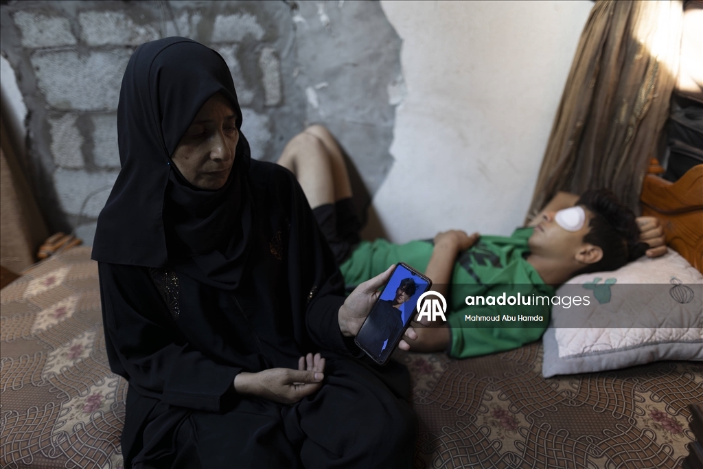 İnsani yardım kuyruğunda İsrail askerlerinin saldırısında vurulan Taha, görme yetisini kaybetti