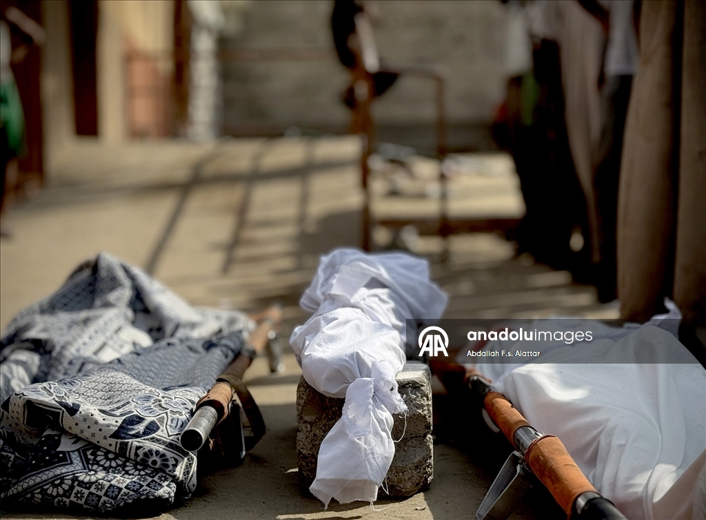 Gazze'de yetersiz beslenme nedeniyle bir çocuk daha hayatını kaybetti