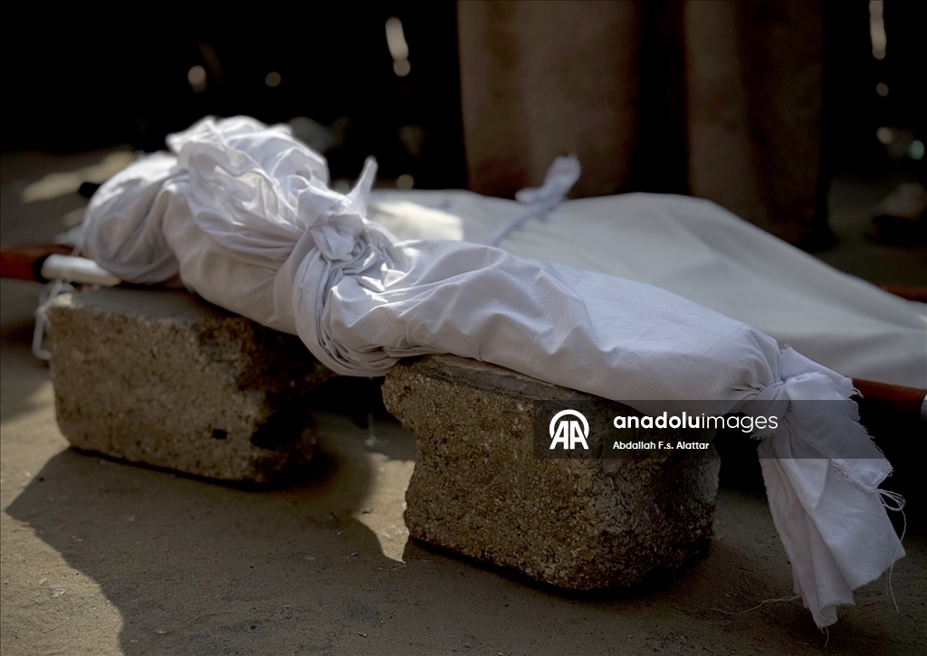 Gazze'de yetersiz beslenme nedeniyle bir çocuk daha hayatını kaybetti