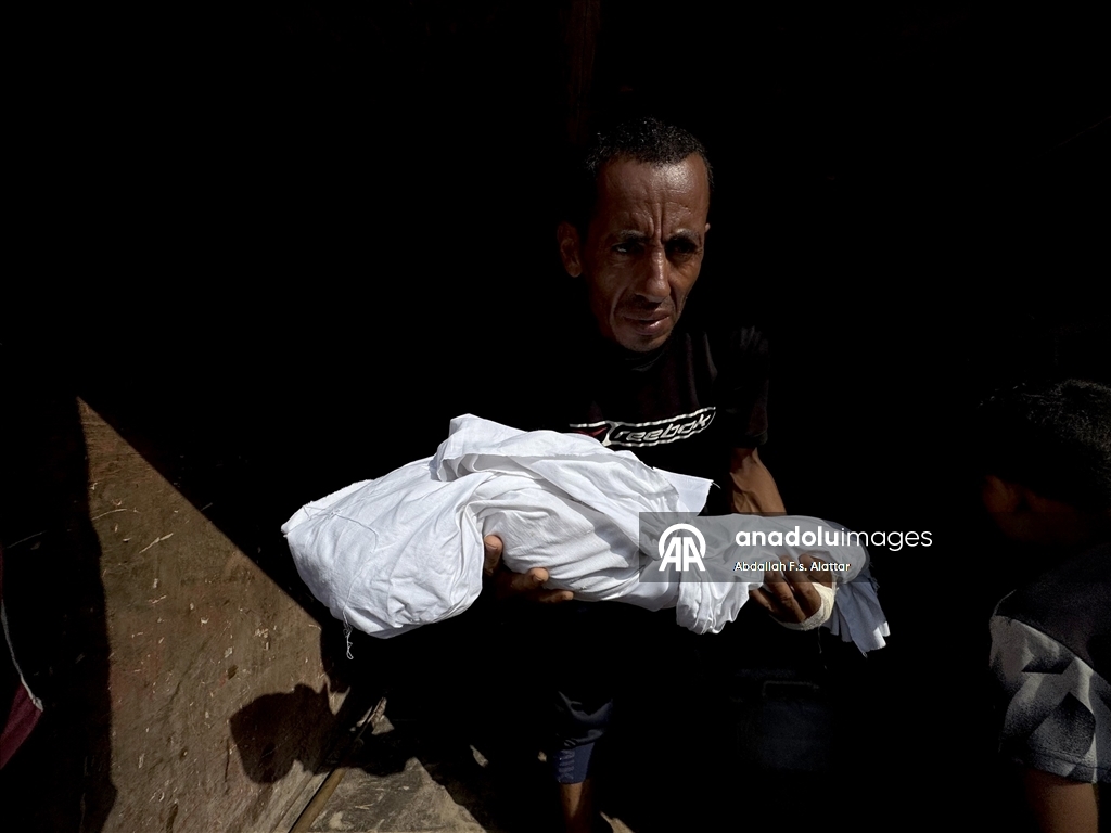 Gazze'de yetersiz beslenme nedeniyle bir çocuk daha hayatını kaybetti